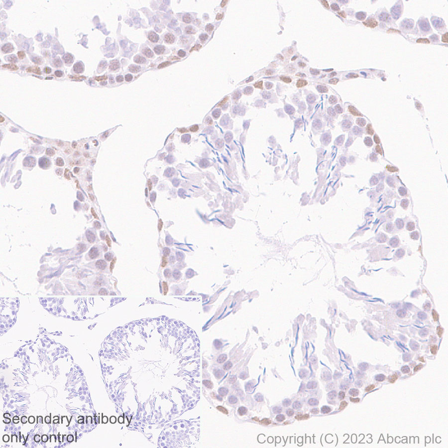 Immunohistochemistry (Formalin/PFA-fixed paraffin-embedded sections) - Anti-MLH1 antibody [EPR26314-1] - BSA and Azide free (ab315012), expandable thumbnail