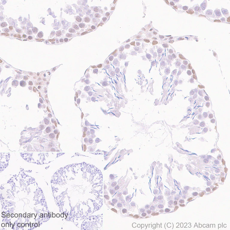 Immunohistochemistry (Formalin/PFA-fixed paraffin-embedded sections) - Anti-MLH1 antibody [EPR26314-1] - BSA and Azide free (AB315012)