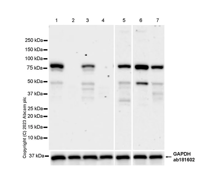 Western blot - Anti-MLH1 antibody [EPR26314-1] - BSA and Azide free (AB315012)