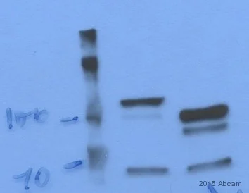 Western blot - Anti-MLH1 antibody [EPR3893] (AB108622)