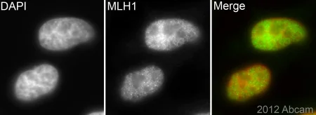 Immunocytochemistry/ Immunofluorescence - Anti-MLH1 antibody [EPR3894] (AB92312)