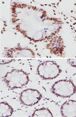 Immunohistochemistry (Formalin/PFA-fixed paraffin-embedded sections) - Anti-MLH1 antibody [EPR3894] (AB92312)