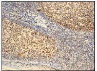 Immunohistochemistry (Formalin/PFA-fixed paraffin-embedded sections) - Anti-MLH1 antibody [EPR3894] (AB92312)