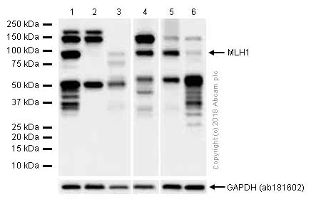 Western blot - Anti-MLH1 antibody [EPR3894] (AB92312)