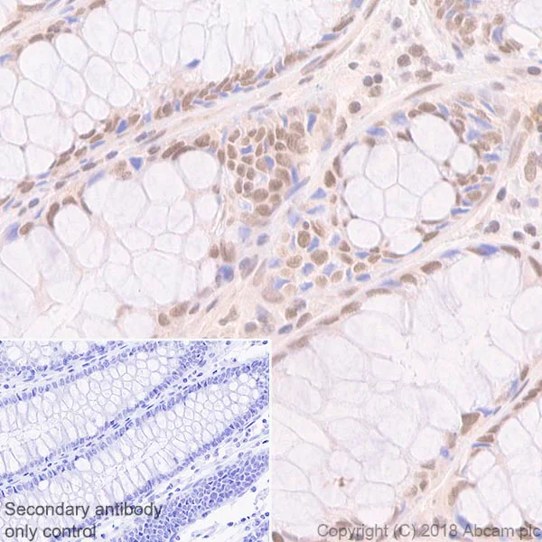 Immunohistochemistry (Formalin/PFA-fixed paraffin-embedded sections) - Anti-MLH1 antibody [EPR3894] - BSA and Azide free (AB214441)