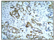 Immunohistochemistry (Formalin/PFA-fixed paraffin-embedded sections) - Anti-MLH1 antibody [EPR3894] - BSA and Azide free (AB214441)