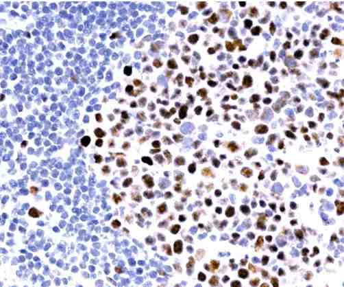 Immunohistochemistry (Formalin/PFA-fixed paraffin-embedded sections) - Anti-MLH1 antibody [G168-15] (AB14206)