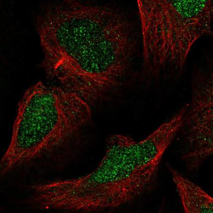 Immunocytochemistry/ Immunofluorescence - Anti-MLH3 antibody (AB221066)