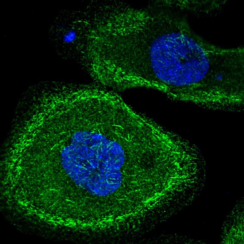 Immunocytochemistry/ Immunofluorescence - Anti-MLK2 antibody (AB251686), expandable thumbnail