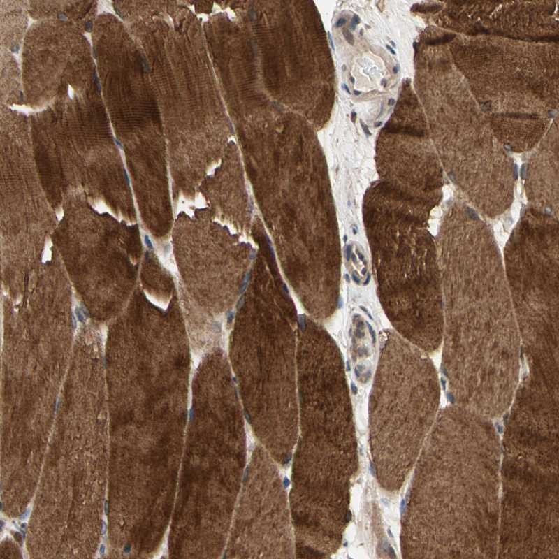 Immunohistochemistry (Formalin/PFA-fixed paraffin-embedded sections) - Anti-MLK2 antibody (AB251686), expandable thumbnail