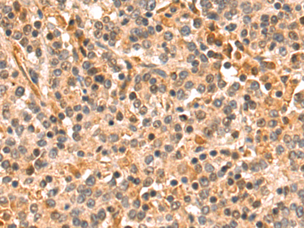 Immunohistochemistry (Formalin/PFA-fixed paraffin-embedded sections) - Anti-MLK3 antibody - C-terminal (AB198844)