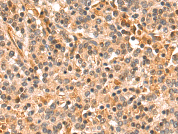 Immunohistochemistry (Formalin/PFA-fixed paraffin-embedded sections) - Anti-MLK3 antibody - C-terminal (AB198844)