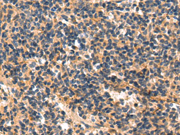 Immunohistochemistry (Formalin/PFA-fixed paraffin-embedded sections) - Anti-MLK3 antibody - C-terminal (AB198844)
