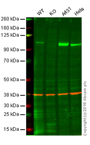Western blot - Anti-MLK3 antibody [EP1460Y] (AB51068), expandable thumbnail