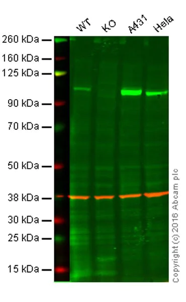 Western blot - Anti-MLK3 antibody [EP1460Y] - BSA and Azide free (AB239840)