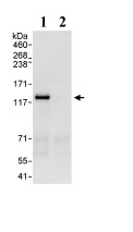 Immunoprecipitation - Anti-MLK4 antibody (AB93798)