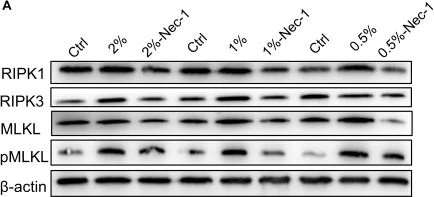 Western blot - Anti-MLKL antibody (AB183770)