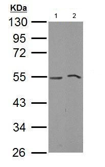 Western blot - Anti-MLKL antibody (AB183770), expandable thumbnail