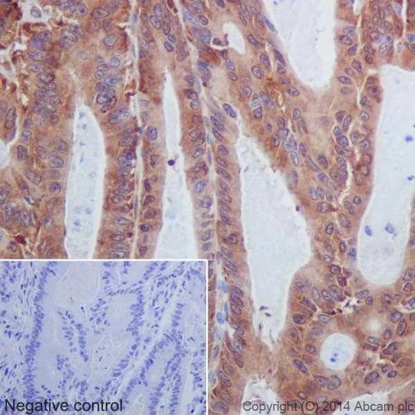 Immunohistochemistry (Formalin/PFA-fixed paraffin-embedded sections) - Anti-MLKL antibody [EPR17514] (AB184718)