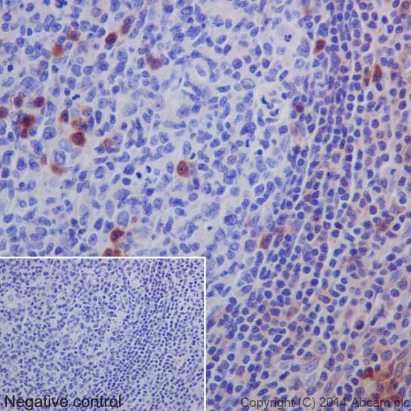 Immunohistochemistry (Formalin/PFA-fixed paraffin-embedded sections) - Anti-MLKL antibody [EPR17514] - BSA and Azide free (AB211045), expandable thumbnail