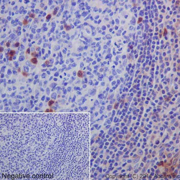 Immunohistochemistry (Formalin/PFA-fixed paraffin-embedded sections) - Anti-MLKL antibody [EPR17514] - BSA and Azide free (AB211045)