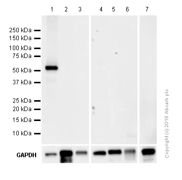 Western blot - Anti-MLKL (phospho S345) antibody [EPR9515(2)] (AB196436)