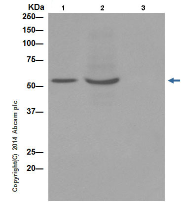 Immunoprecipitation - Anti-MLKL (phospho S345) antibody [EPR9515(2)] - BSA and Azide free (AB208910), expandable thumbnail