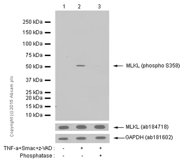 Western blot - Anti-MLKL (phospho S358) antibody [EPR9514] (AB187091)