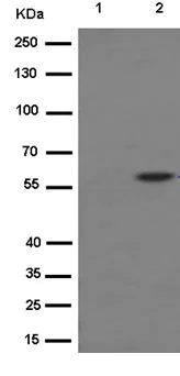 Western blot - Anti-MLKL (phospho S358) antibody [EPR9514] (AB187091)