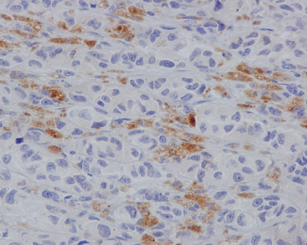 Immunohistochemistry (Formalin/PFA-fixed paraffin-embedded sections) - Anti-MLKL (phospho S358) antibody [EPR9514] - BSA and Azide free (AB208909), expandable thumbnail