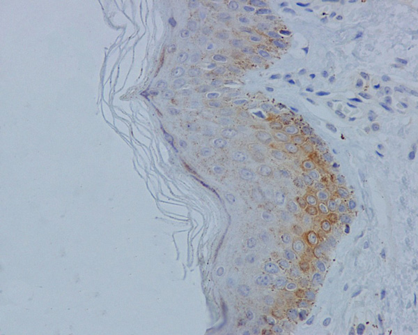Immunohistochemistry (Formalin/PFA-fixed paraffin-embedded sections) - Anti-MLKL (phospho S358) antibody [EPR9514] - BSA and Azide free (AB208909), expandable thumbnail