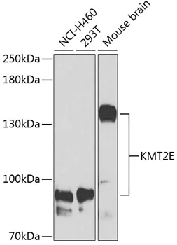 Western blot - Anti-MLL5 antibody (AB192582)