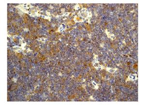 Immunohistochemistry (Formalin/PFA-fixed paraffin-embedded sections) - Anti-MLLT11 antibody [CHCR115] (AB109016)