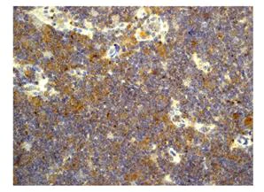 Immunohistochemistry (Formalin/PFA-fixed paraffin-embedded sections) - Anti-MLLT11 antibody [CHCR115] (AB109016)
