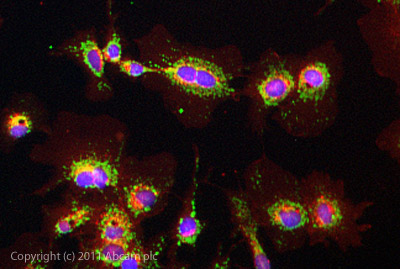 Immunocytochemistry/ Immunofluorescence - Anti-MLN64 antibody (AB3478)