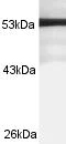 Western blot - Anti-MLN64 antibody (AB3478)