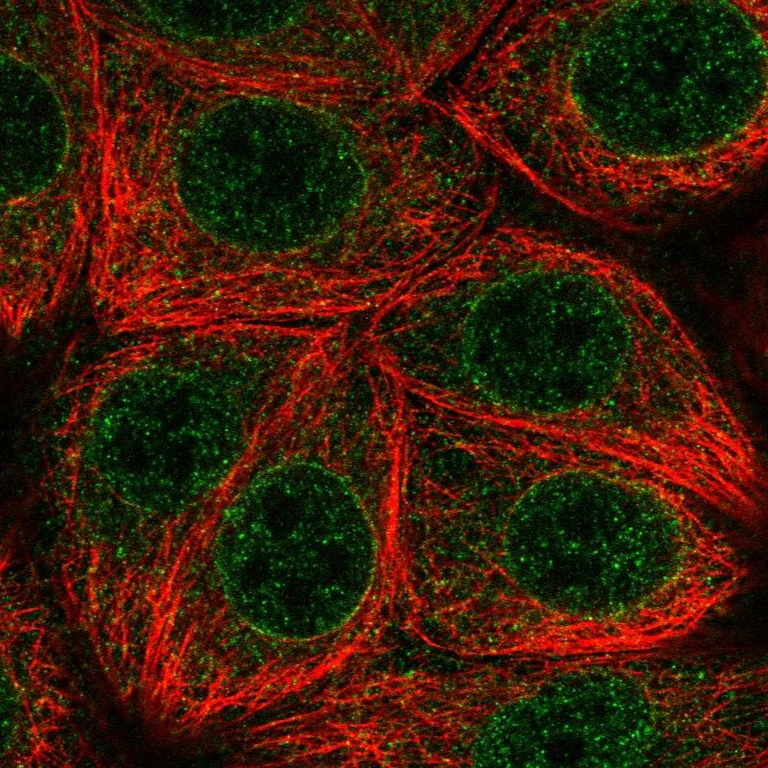 Immunocytochemistry/ Immunofluorescence - Anti-MLX Antibody (AB327259)