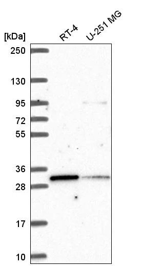 Western blot - Anti-MLX Antibody (AB327259)