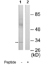 Western blot - Anti-MLX antibody (AB65147)