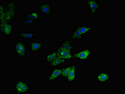 Immunocytochemistry/ Immunofluorescence - Anti-MLYCD/MCD antibody (AB234879), expandable thumbnail