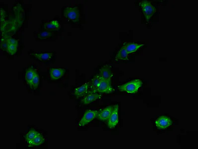 Immunocytochemistry/ Immunofluorescence - Anti-MLYCD/MCD antibody (AB234879)