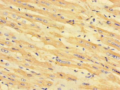 Immunohistochemistry (Formalin/PFA-fixed paraffin-embedded sections) - Anti-MLYCD/MCD antibody (AB234879), expandable thumbnail