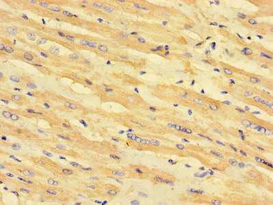 Immunohistochemistry (Formalin/PFA-fixed paraffin-embedded sections) - Anti-MLYCD/MCD antibody (AB234879)