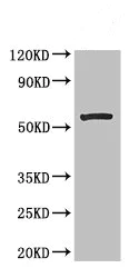Western blot - Anti-MLYCD/MCD antibody (AB234879)