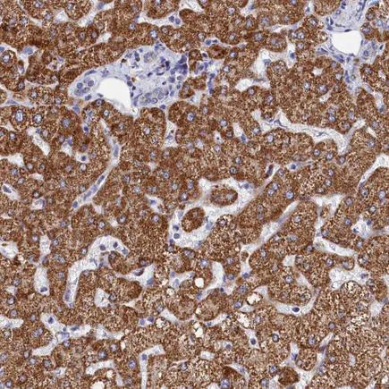 Immunohistochemistry (Formalin/PFA-fixed paraffin-embedded sections) - Anti-MMAB antibody (AB243596)