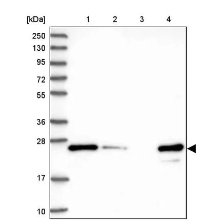 Western blot - Anti-MMAB antibody (AB243596)