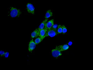 Immunocytochemistry/ Immunofluorescence - Anti-MMAB antibody [EPR8695] - BSA and Azide free (AB249822)