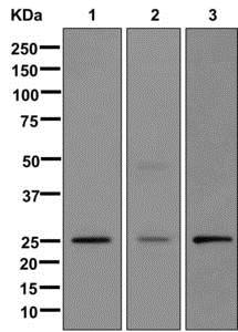 Western blot - Anti-MMAB antibody [EPR8695] - BSA and Azide free (AB249822), expandable thumbnail