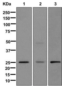 Western blot - Anti-MMAB antibody [EPR8695] - BSA and Azide free (AB249822)