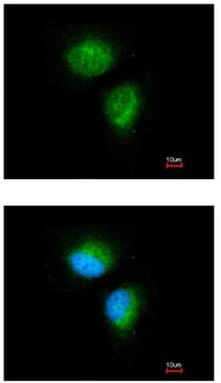 Immunocytochemistry/ Immunofluorescence - Anti-MMACHC/CblC antibody (AB96195)